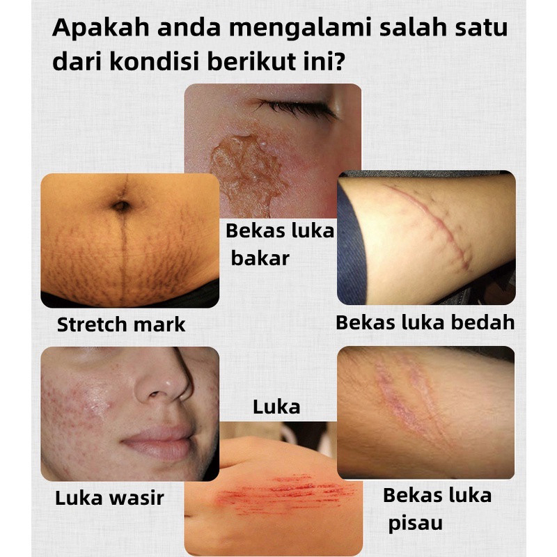 Minyak kuda 30g untuk mengobati tangan dan kaki pecah-pecah/tangan dan kaki kering dan mengelupas/kr
