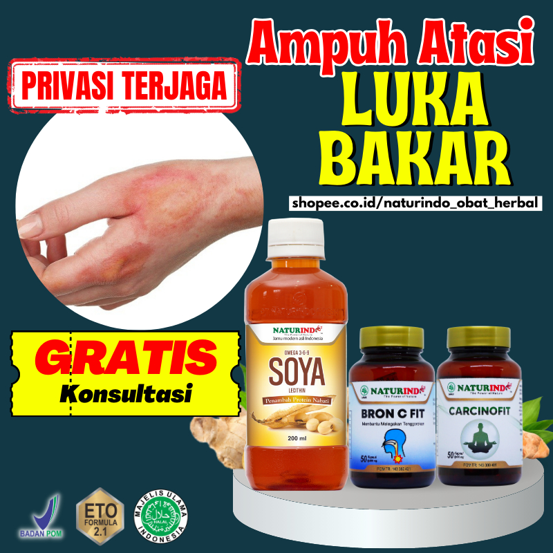 Paket Obat Herbal Penghilang Bekas Luka Bakar Melepuh Koreng Obat Kulit Keloid Hiperpigmentasi Panu 