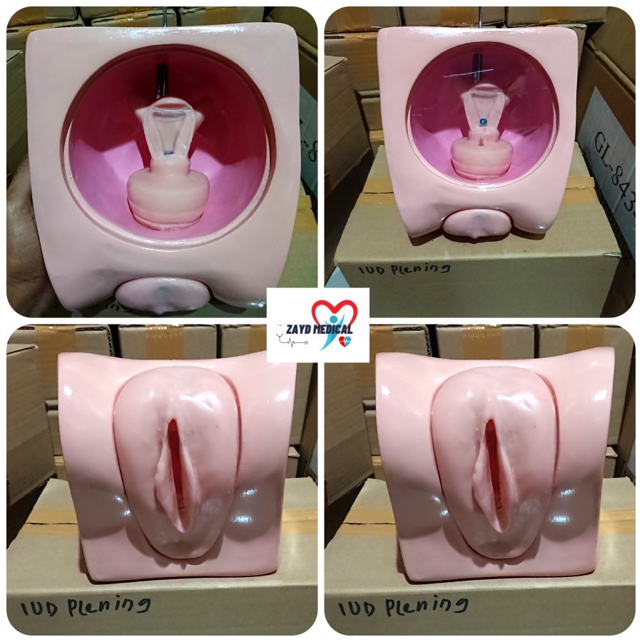 Phantom Manikin Alat Peraga Model Intrauterine Device Iud