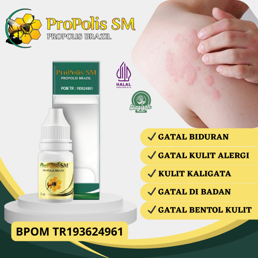 Obat Biduran Gatal di Seluruh Badan, Obat Kaligata, Obat Bentol di Kulit, Obat Alergi Dingin, Obat K