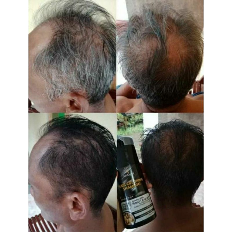 Shampo penghilang uban