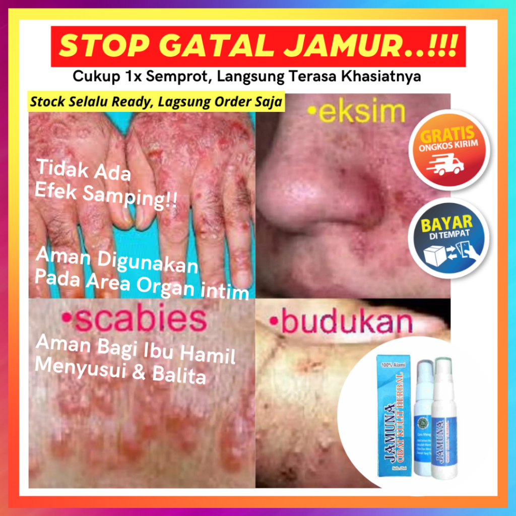 Jamuna Itchy Herbal - Obat Gatal Kulit Paling Ampuh Seluruh Badan Paling Ampuh Gatal Miss V kewanita