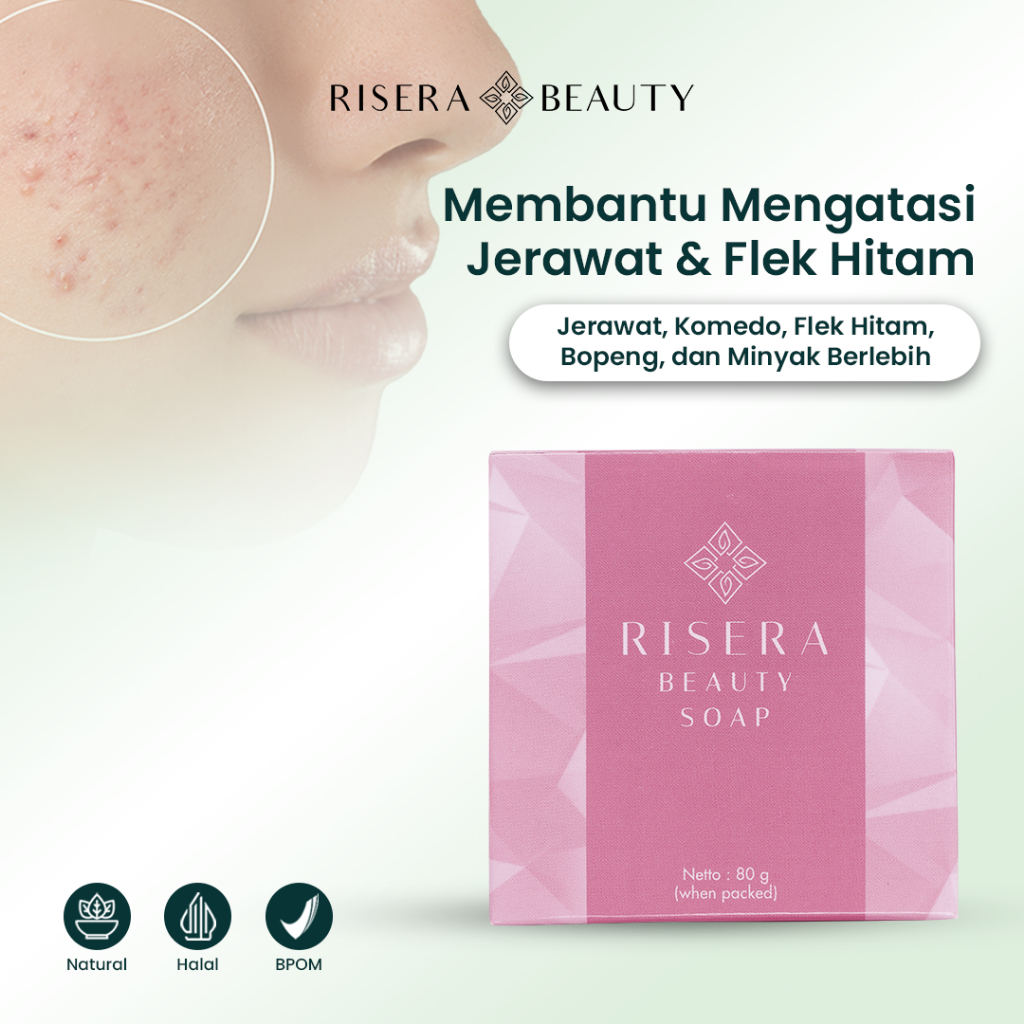 RISERA BEAUTY Acne Soap Penghilang Jerawat,Komedo Dan Flek Hitam Menyamarkan warna kulit tidak rata
