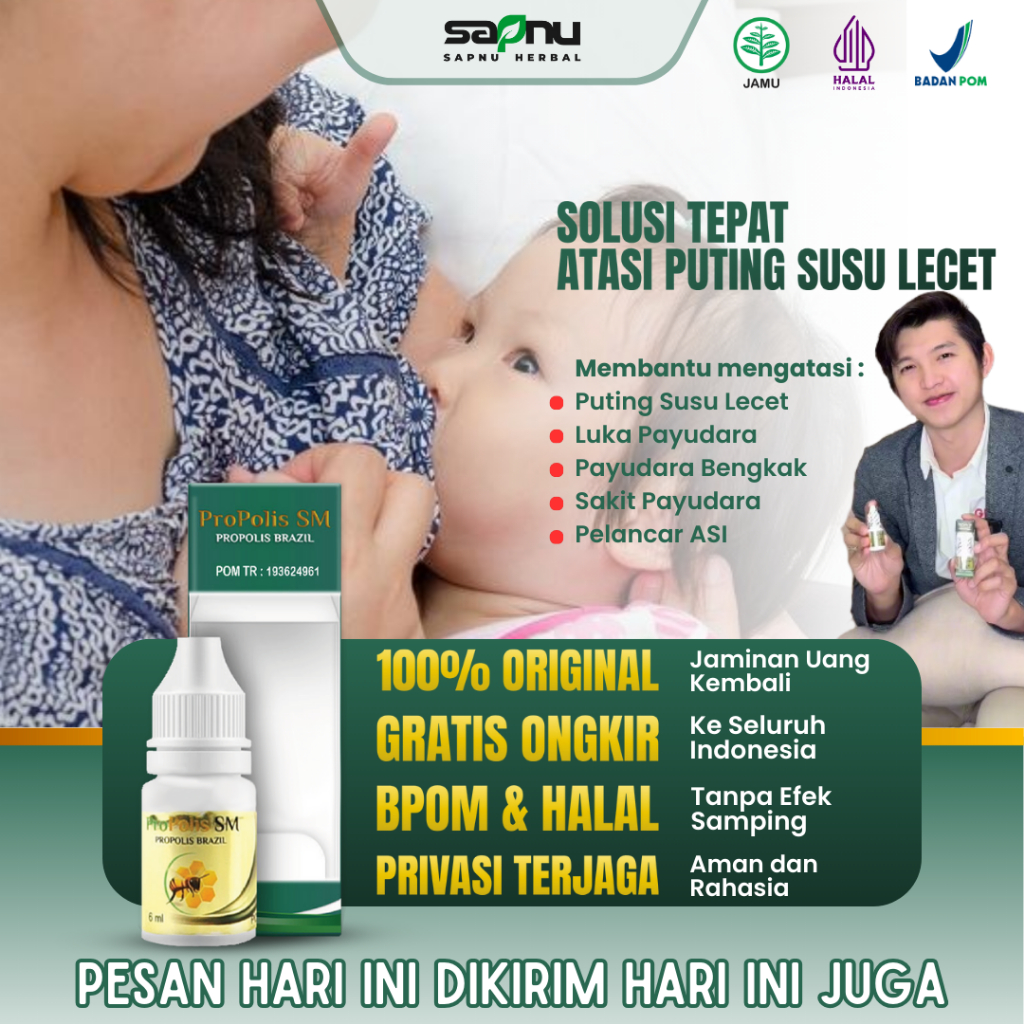 Propolis SM Obat Puting Susu Lecet, Obat Puting Susu Lecet Menyusui, Obat Puting Susu Luka, Obat Fis