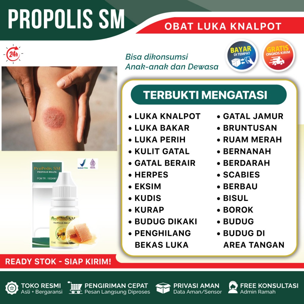 Obat Luka Knalpot, Obat Bekas Luka Knalpot, Obat Luka Bakar Knalpot - Propolis SM Original - Isi 6ml