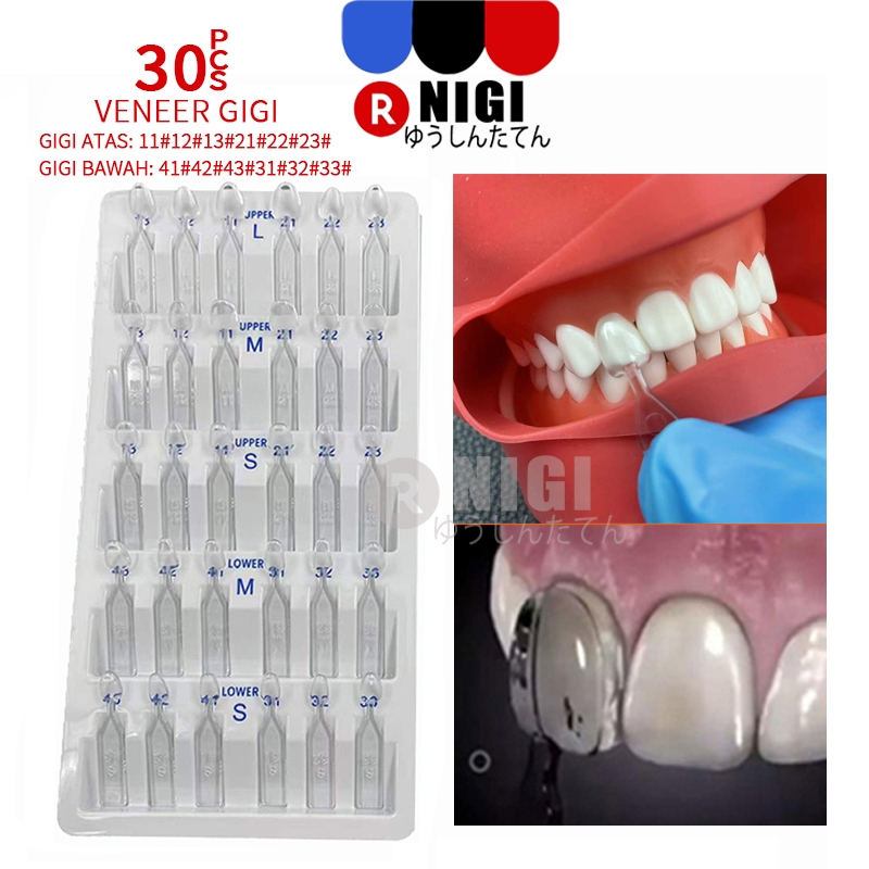 NIGI 30PCS Veneer Gigi Dental Cetakan Veneer Gigi Alat Pemutih Gigi Veneer