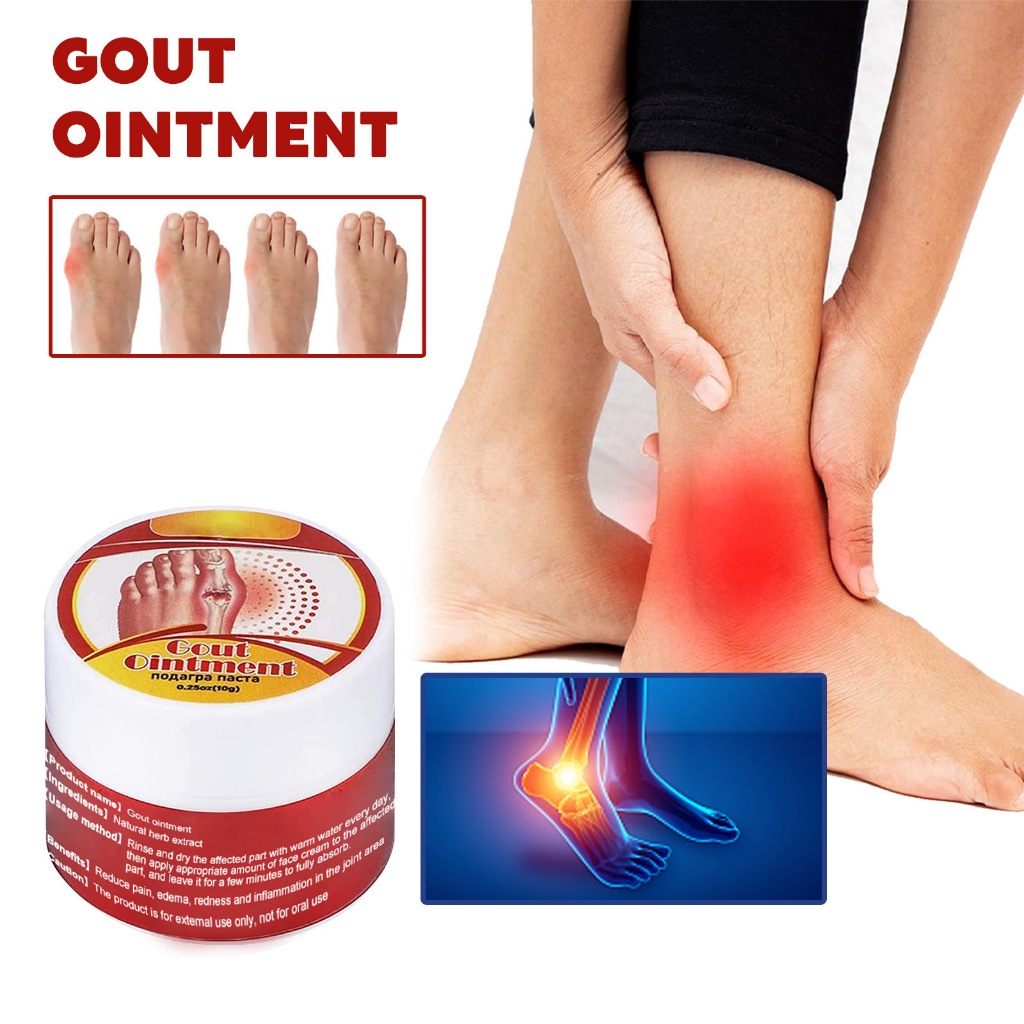 South Moon Gout Ointment Original 10g Soothing Pain Relief Massage Gel Gout Cream Salep Bunion Pain 