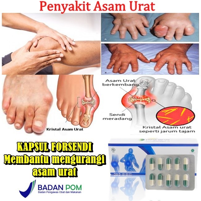 Forsendi 60 kapsul obat nyeri sendi dan tulang obat herbal asam urat