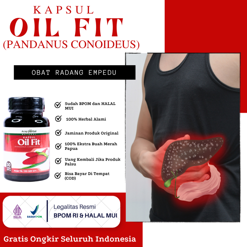 Obat Radang Empedu, Batu Empedu, Kolesistitis Akut, Penyumbatan di Saluran Empedu, Kolesistitis Akut