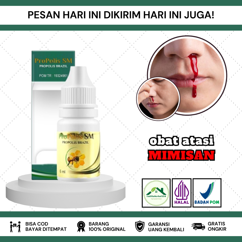 Obat Mimisan, Obat Sering Mimisan, Obat Mimisan dan Sakit Kepala, Obat Mimisan Sebelah Kiri/Kanan, O