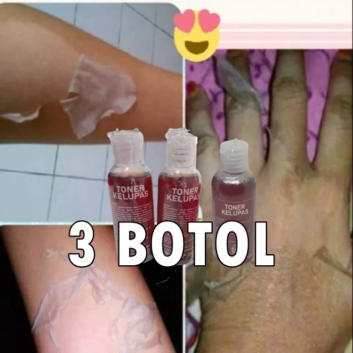 TONER BPOM 3 PCS Pengelupasan Sel kulit Mati