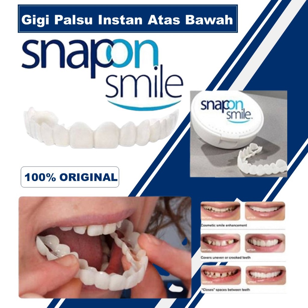 Snap On Smile Gigi Palsu 1 Set Atas Bawah - Gigi Palsu Silikon | Snap On Smile 100% Original Authent