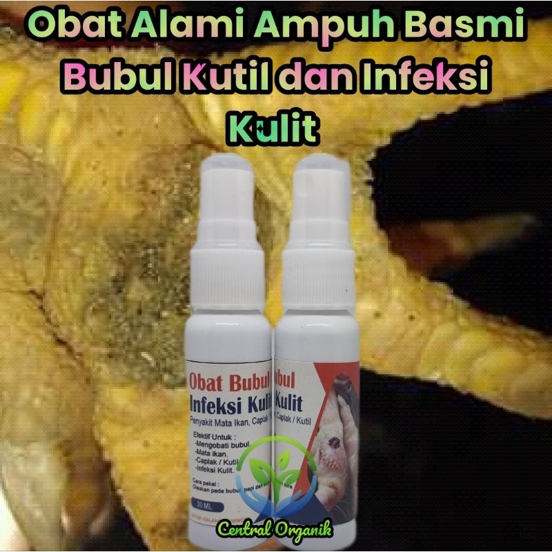 Obat Bubul Ayam Ampuh Obat Alami Penghilang Bubul Kutil Kaki Ayam