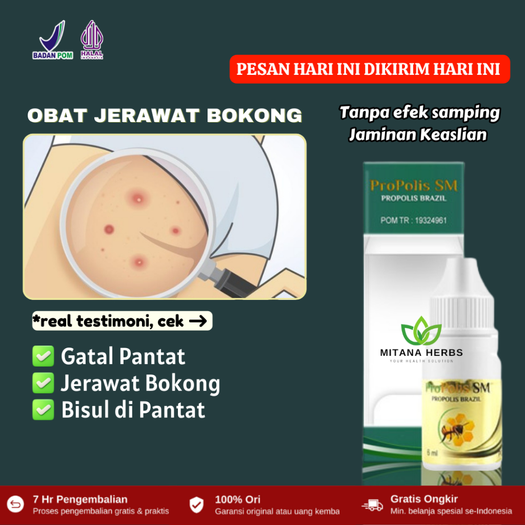 Salep Jerawat Bokong, Obat Bisul di Pantat, Obat Gatal Pantat Jerawat Pantat, Pantat Bruntusan