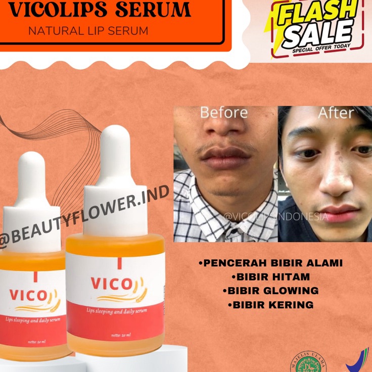 COD VICO LIPS SERUM BIBIR ORIGINAL  PENCERAH BIBIR  SERUM BIBIR  PEMERAH BIBIR  PEMERAH BIBIR PERMAN