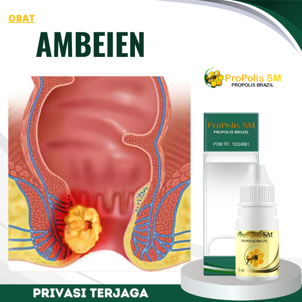 Obat Ambeien, Obat Wasir, Obat Benjolan Ambeien, Obat Ambeien Anak Dan Dewasa, Obat Pengempis Ambeie