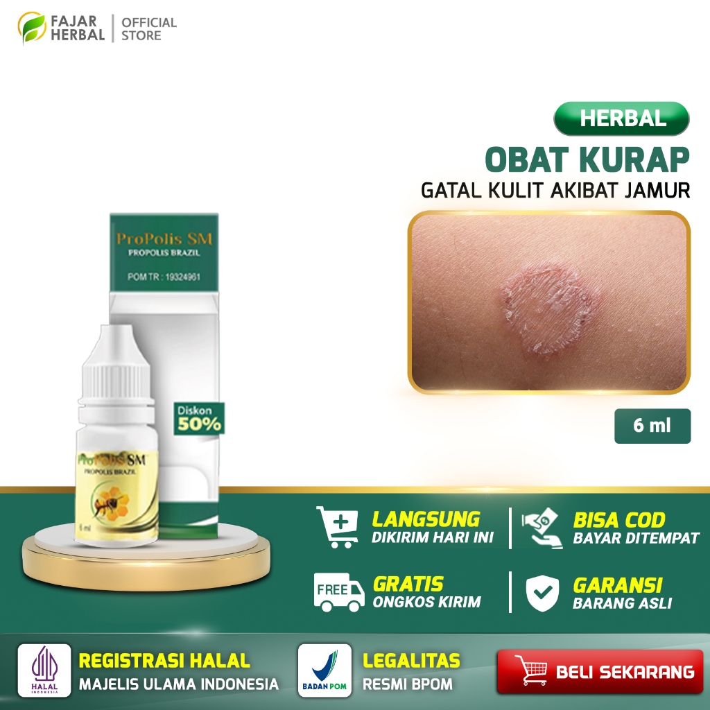 Obat Lecet Luka Kelamin Pria Wanita Anak Dewasa Kadas Kurap Kutil Keputihan Miss Vagina Propolis SM