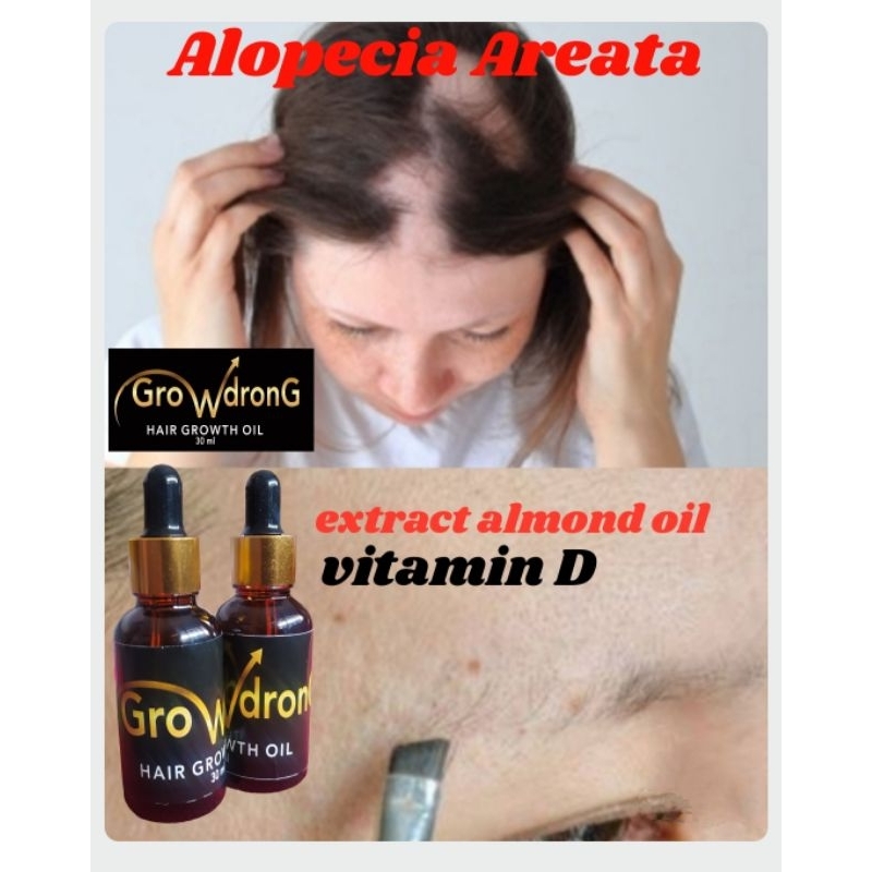 penumbuh rambut/botak koin