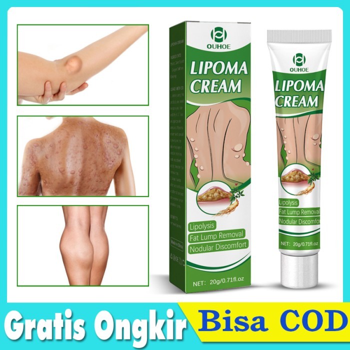 SUMIFUN LIPOMA CREAM SALEP LIPOMA HERBAL