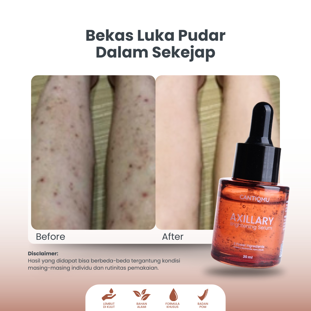 CANTIQMU Axillary Brightening Serum Penghilang Bekas Luka Pencerah Ketiak Selangkangan Bokong Leher