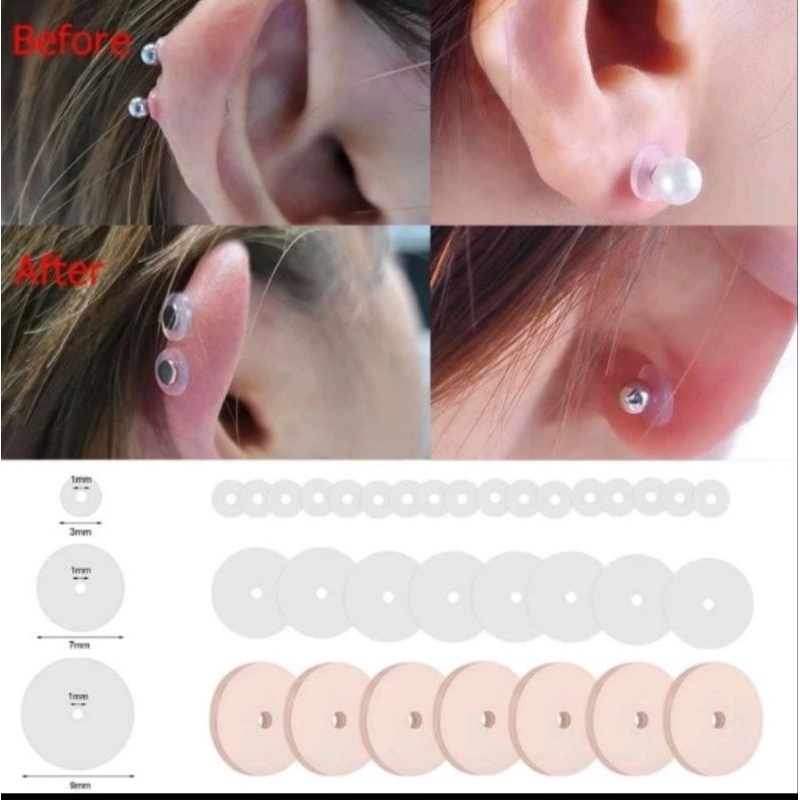 ICH nopull piercing / obat tindikan keloid