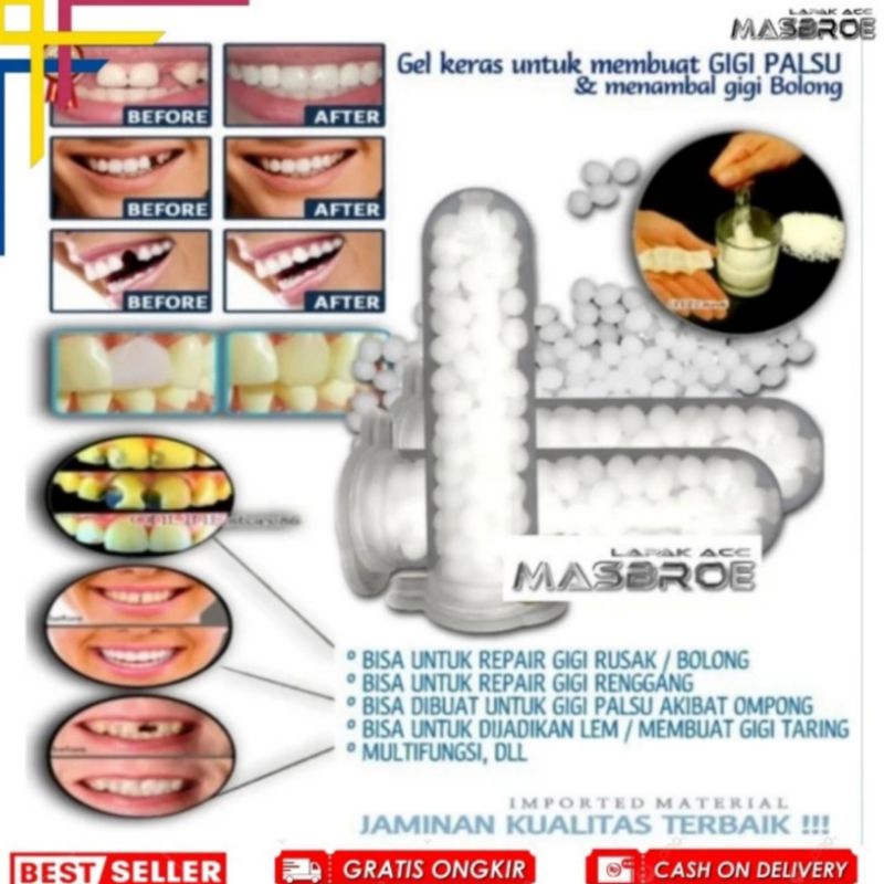 Original Temptooth Lem Penambal Gigi Palsu & Berlubang 100 Butir