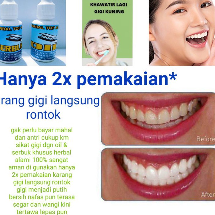 

HJ6 PERONTOK KARANG GIGI PEMUTIH GIGI KUNING 1 AMPUH