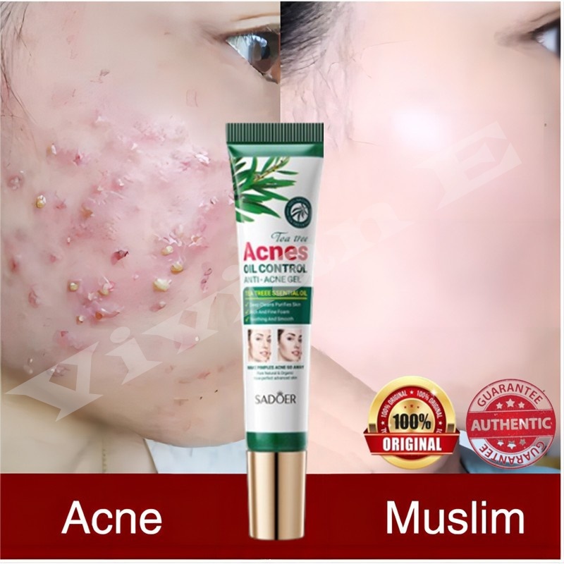 Krim Penghilang Jerawat dan Bekas Jerawat Cream Jerawat Menghilangkan Jerawat Bruntusan Ampuh Cepat