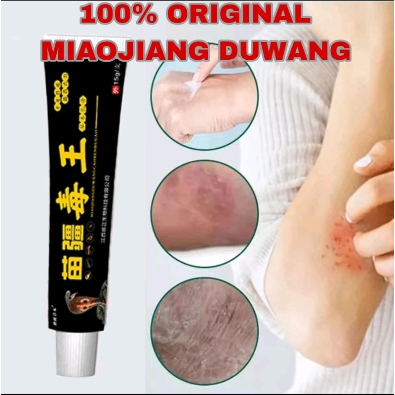 Promo MIAOJIANG DUWANG HIJAU ASLI 100%ORIGINAL Salep duwang 15g psoriasis Eksim cream jamur kurap al