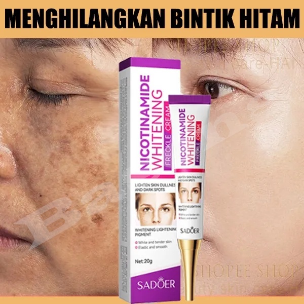 Menghilangkan flek hitam di wajah cream flek hitam membandel cream penghilang flek hitam 20g flek cr