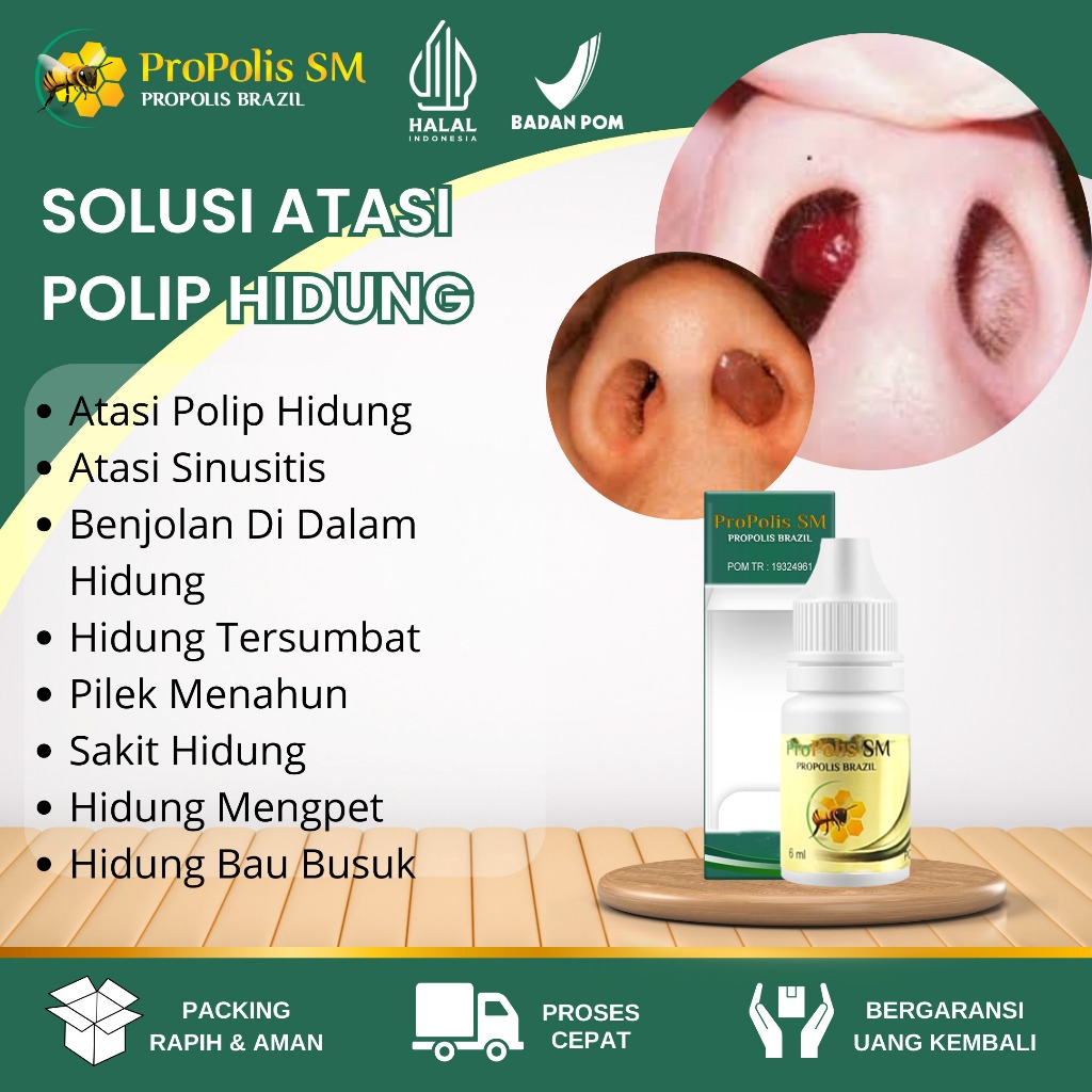 Obat Sinusitis Hidung - Polip Hidung - Flu - Pilek - Polip Akut - Polip Kronis - Hidung Tersumbat