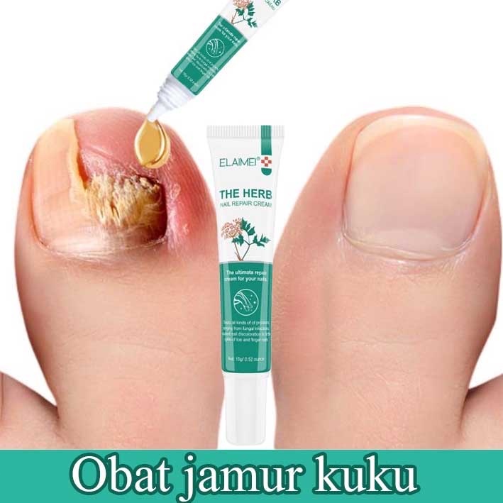 [Alivee]Elaimei Herb Obat Kuku Rusak Anti Jamur Perawatan Kuku Rusak Nail Repair Cream -AL
