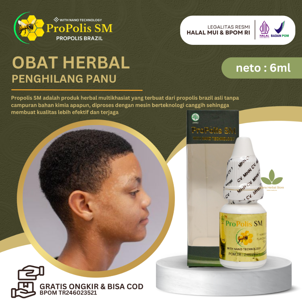Obat Penghilang Panu - Obat Panu Anak - Obat Jamur Kulit - Obat Hapuran Kulit - Obat Balas Bogo - Ob