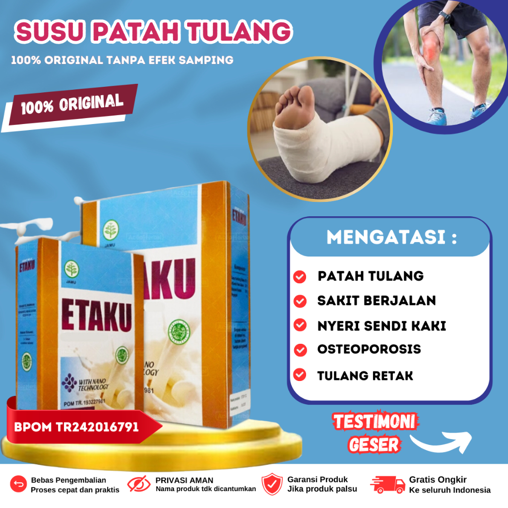 

Susu Kesehatan Tulang Dan Sendi , Patah Tulang dan Tulang Bergeser, Kaki Bengkak Pengapuran Tulang