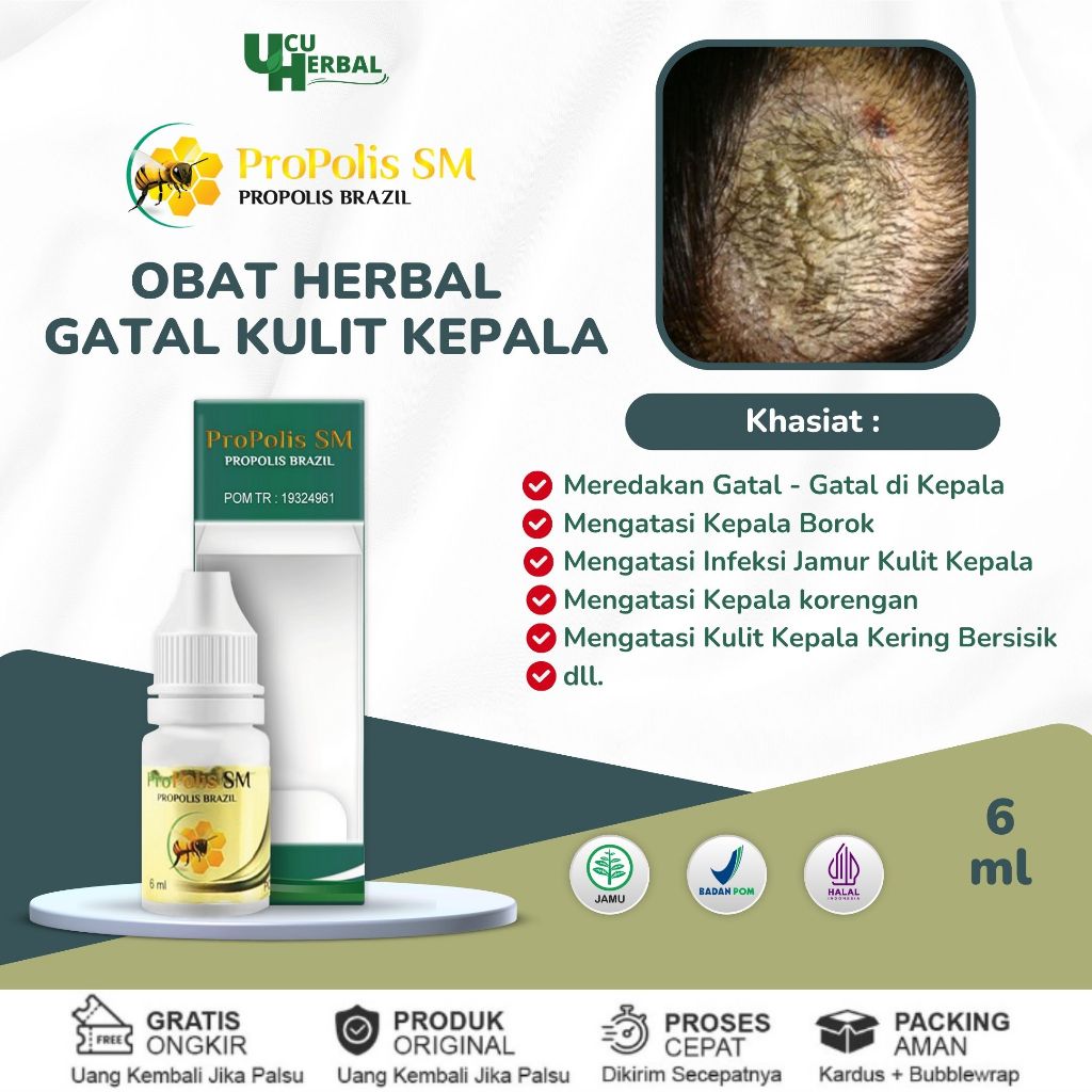 Obat Tetes Gatal Kepala, Obat Borok di Kepala, Obat Kulit Kepala Berjamur, Infeksi Jamur Kulit, Obat