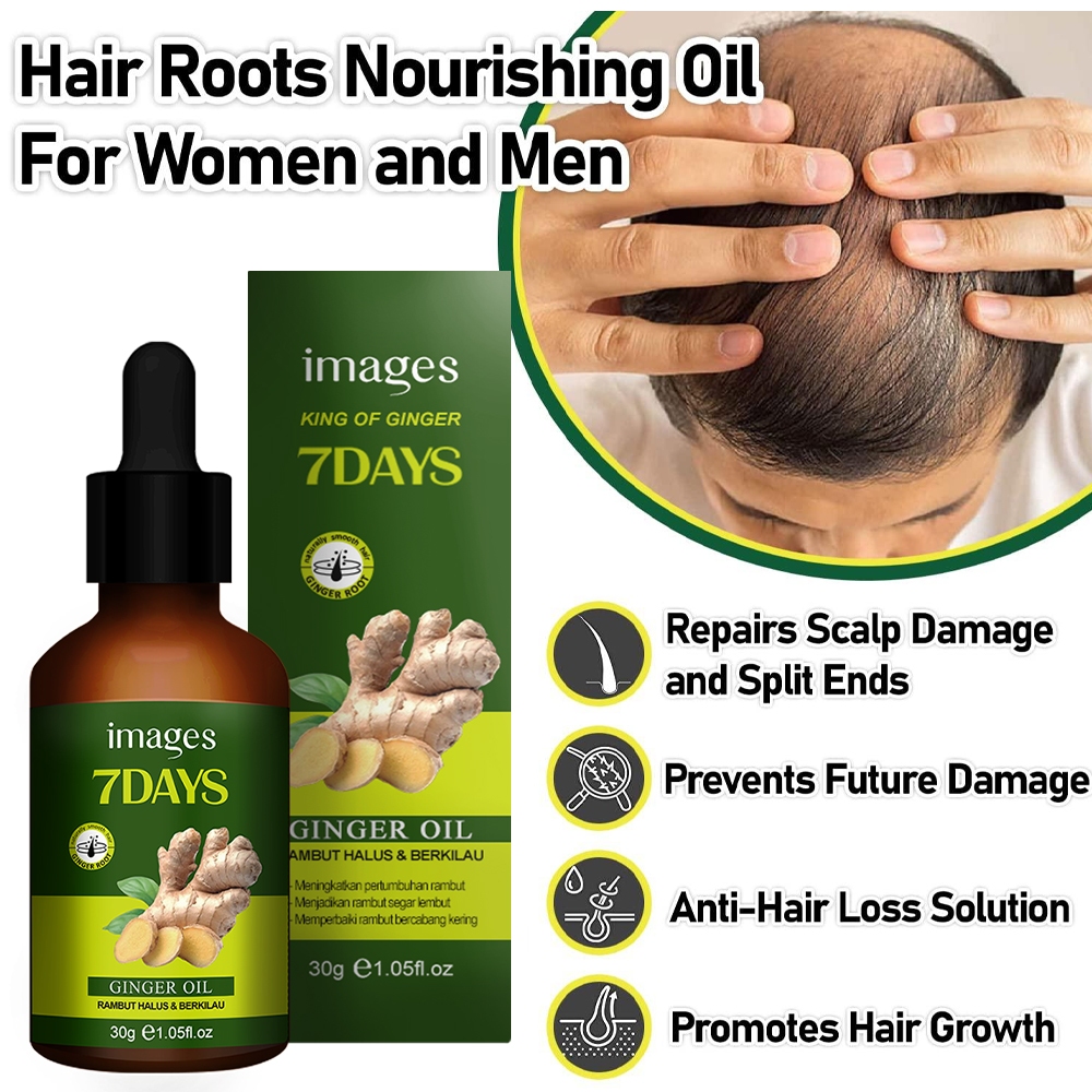 Serum Penumbuh Rambut Paling Ampuh Perawatan Rambut 30ml / Images King Of Ginger 7 Days 30ml