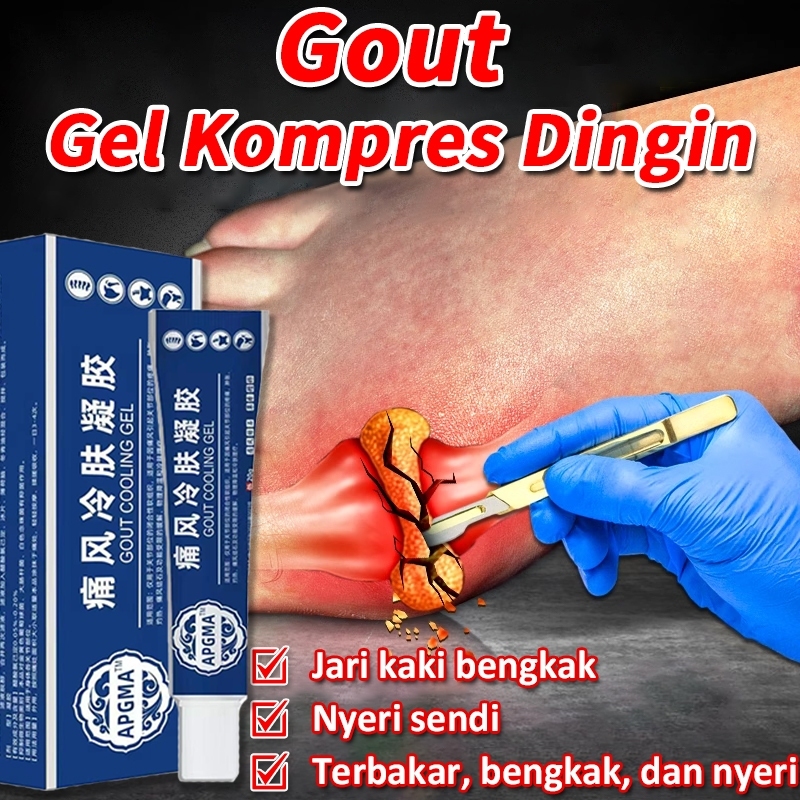 Obat Cina Asam Urat Obat Asam Urat Obat Nyeri Sendi Nyeri Tulang Sendi Lutut Pijat Tangan Kaki Untuk
