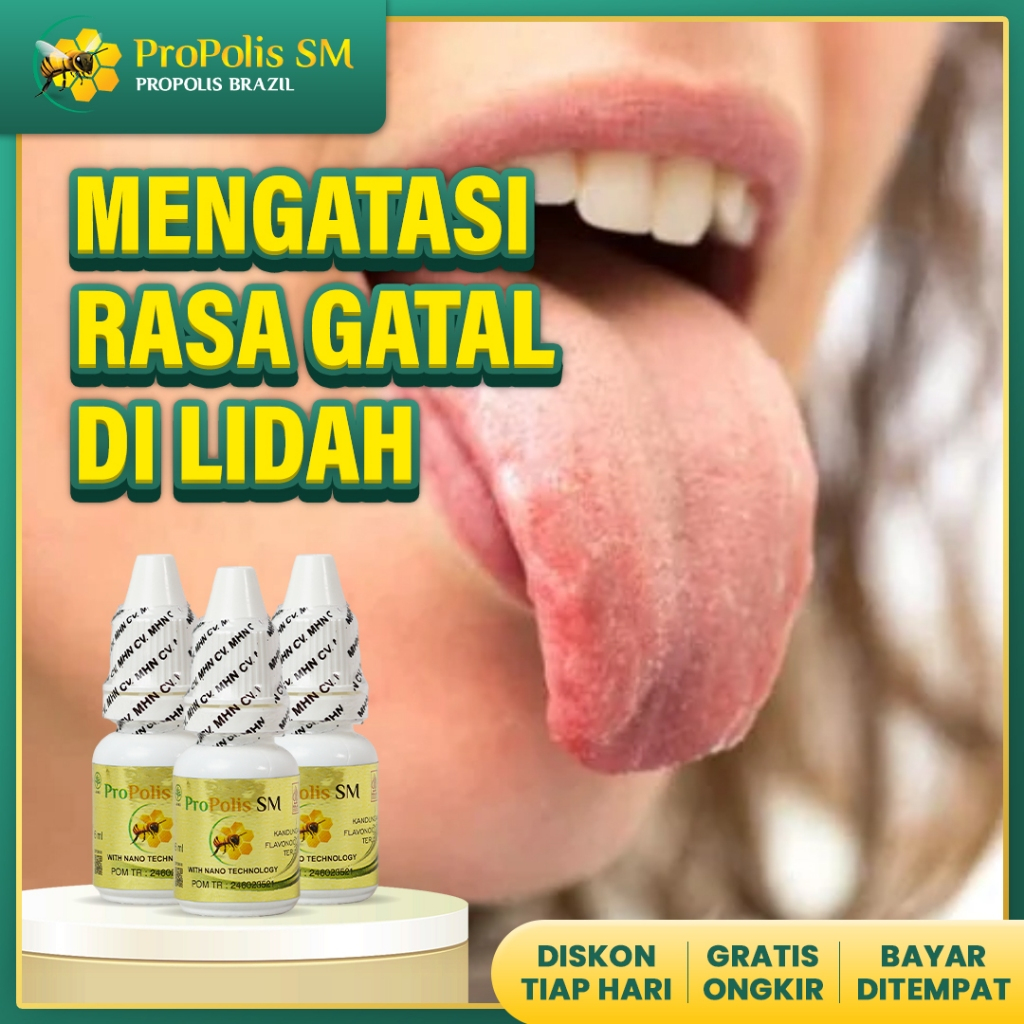 Obat rasa gatal di lidah,Obat Lidah Putih Dewasa, Lidah Berjamur, Lidah Pecah Pecah propolis sm