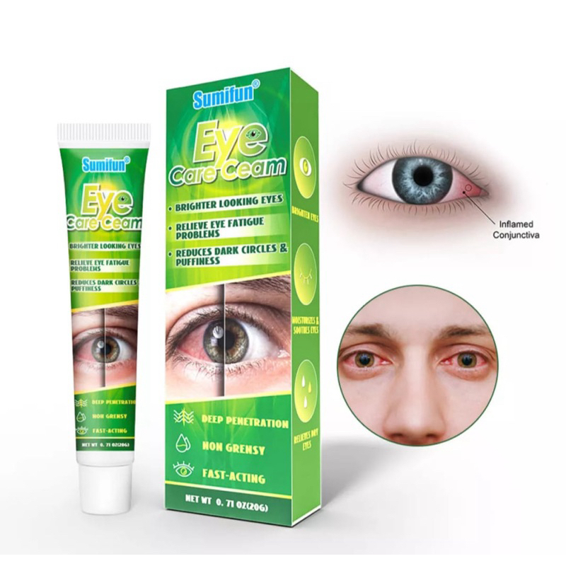 Cream Mata Merah/Cream Sakit Mata/EyeCare Cream