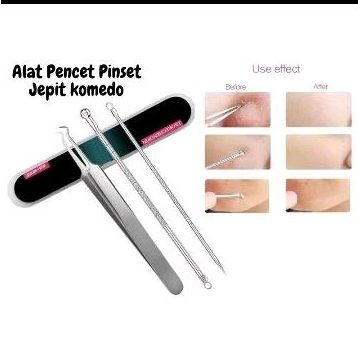 Pinset Komedo / Set Pinset Komedo isi 3 / Pinset Set Box