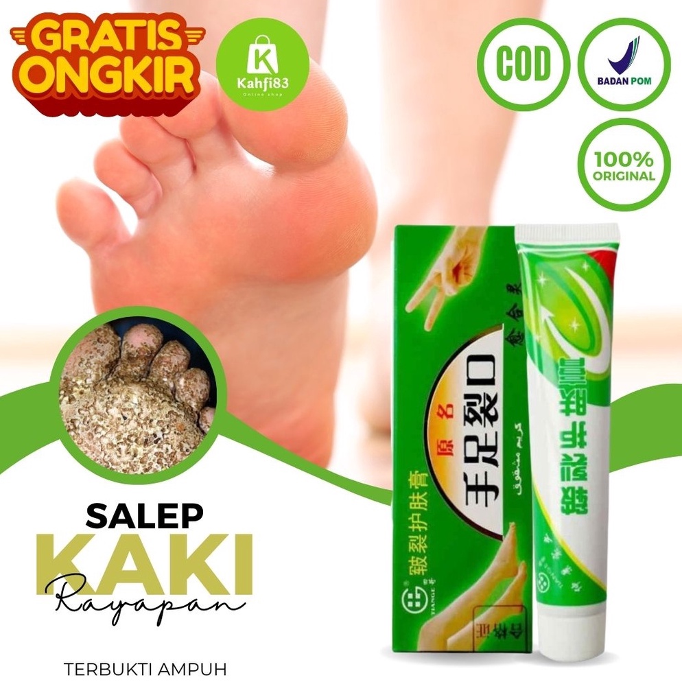 KODE W87E Obat Kaki Pecah Pecah dan Kering dan Kasar  Obat Kaki Rayapan dan Bau Penghilang Kapalan K