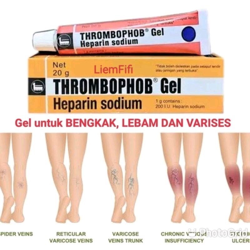 Thrombophob Gel 20gr/Memar/trombopop/bengkak/thrombopop/bengkak