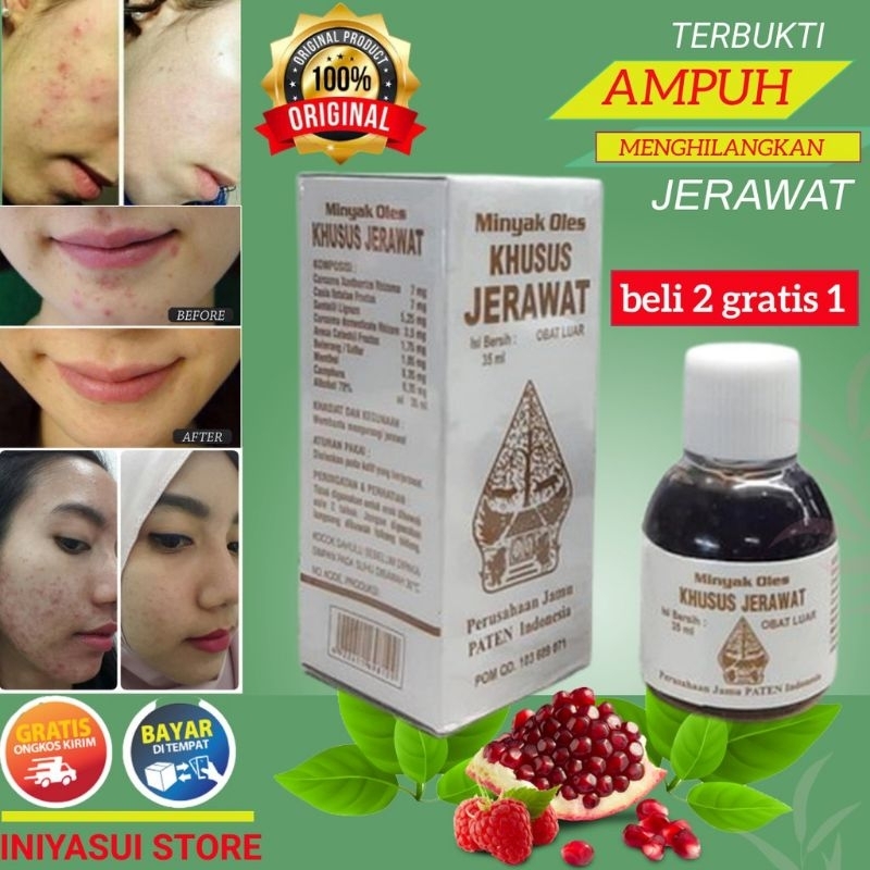 

Premium ORIGINAL! Minyak Oles Khusus Jerawat Cap Wayang terbaik / Obat Jerawat Ampuh / Penghilang