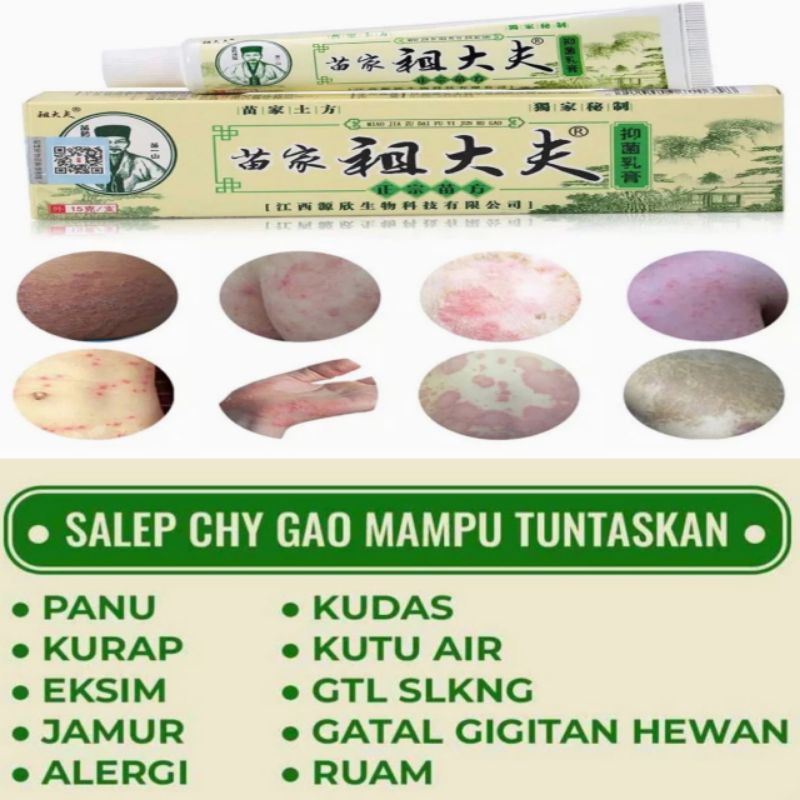 (azli 100% )salep gatal kulit panu, kudis, kurap, exzim