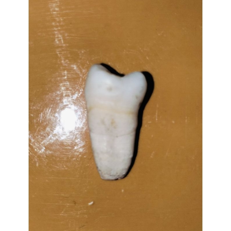 Gigi asli premolar 24