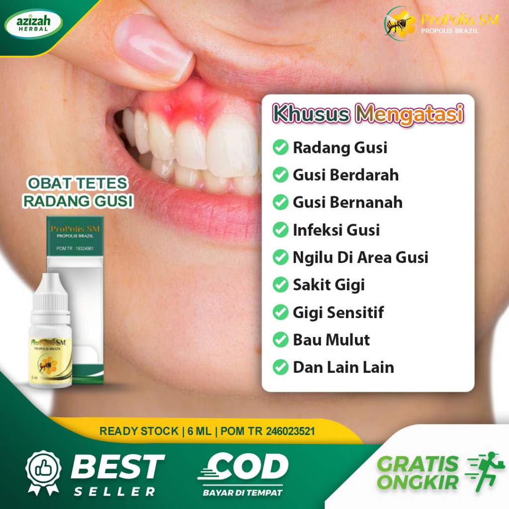 Obat Radang Gusi Bengkak Merah Berdarah Bernanah Infeksi Syaraf Gusi Gigi Terasa Ngilu Propolis SM