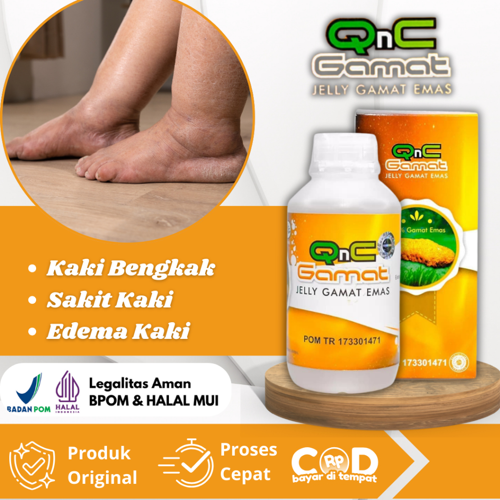 Obat Kaki Bengkak, Kaki Bengkak dan Nyeri, Kaki Bengkak Ibu Hamil, Kaki Bengkak Karena Jatuh, Sakit 