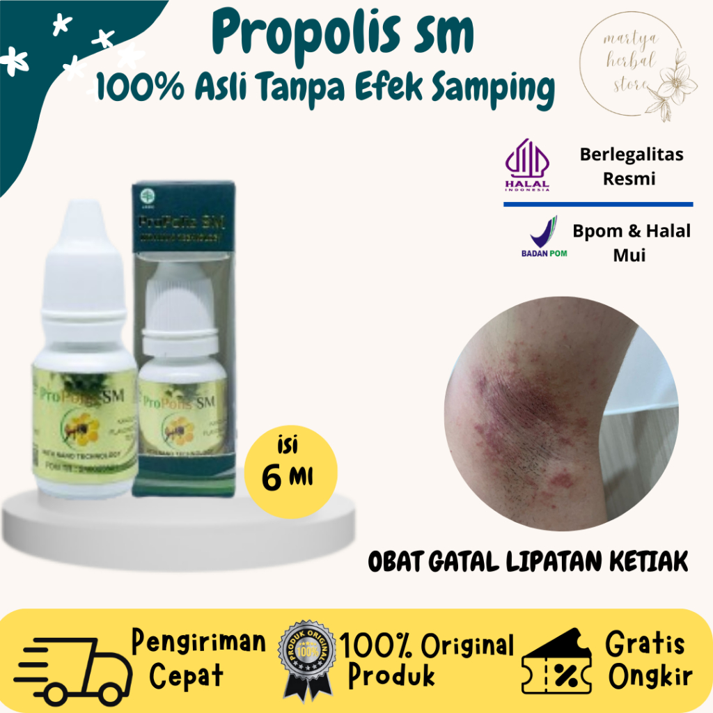 Obat Herbal Gatal Ketiak Obat Lipatan Ketiak Lecet Obat Iritasi Ketiak Obat infeksi Jamur Ketiak Oba