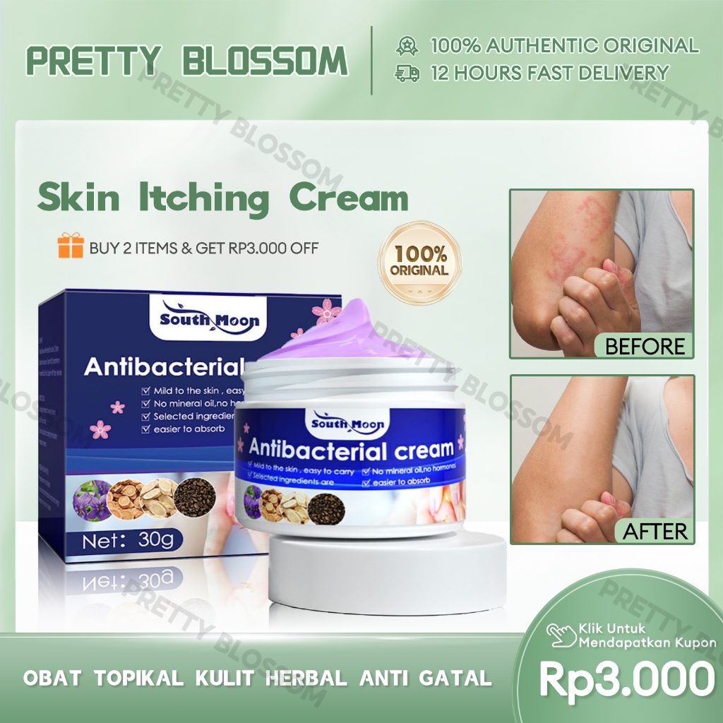 South Moon Skin Itching Cream 30g Herbal Antibacterial Cream Herpes Anti Itching Psoriasis Cream
