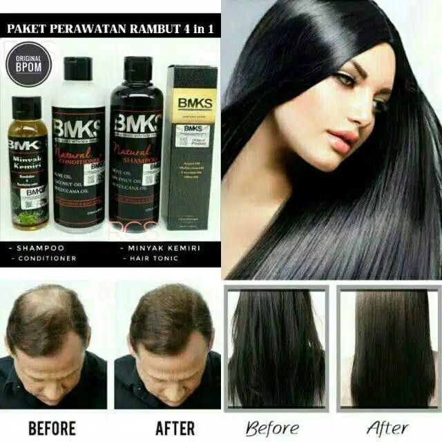 Paket 4in1 Penumbuh Rambut Shampo+Kondisioner+Minyak+Tonic - BMKS Kemiri